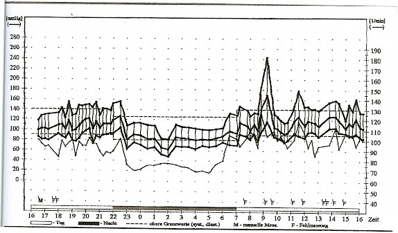 Langzeit-Blutdruckmessung mit mentaler Stressbelastung um 9Uhr, Blutdruck-Spitze bis 243/115 mmHg